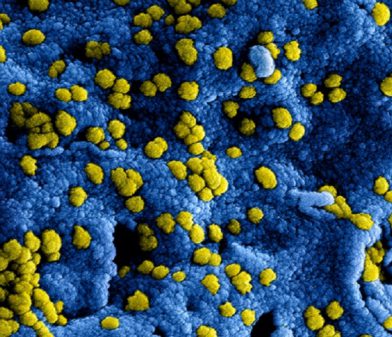 coronavirus
